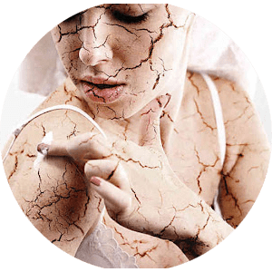 Atopowe zapalenie skóry - leczenie
